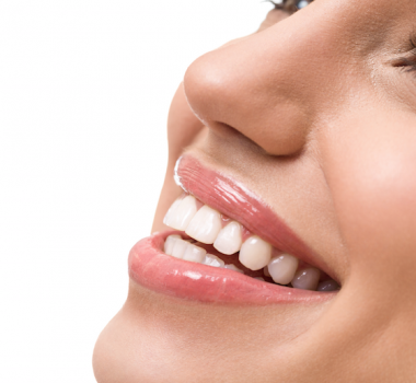 Fresh Dental Tyler: Teeth Whitening