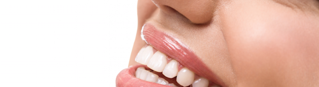 Fresh Dental Tyler: Teeth Whitening